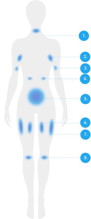 CoolSculpting fat freezing Dublin - front body diagram with numbered treatable fat areas Front body diagram with numbered treatable fat areas for CoolSculpting fat freezing in Dublin